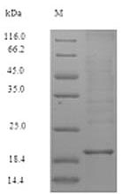 Greater than 90% as determined by SDS-PAGE.Recombinant Human Zymogen Granule Protein 16 Homolog B (ZG16B) Protein (His)