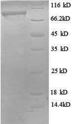 Greater than 90% as determined by SDS-PAGE.