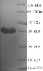 Greater than 90% as determined by SDS-PAGE.