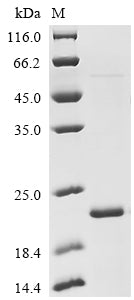Greater than 85% as determined by SDS-PAGE.Recombinant Mouse Cd109 Antigen (CD109) Protein (His)