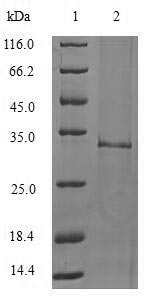 Greater than 90% as determined by SDS-PAGE.Recombinant Mouse Interleukin-1 Family Member 10 (IL1F10) Protein (His-SUMO)