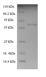 Greater than 90% as determined by SDS-PAGE.