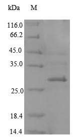 Greater than 90% as determined by SDS-PAGE.Recombinant Mouse C-Type Lectin Domain Family 4 Member K (CD207) Protein (His)