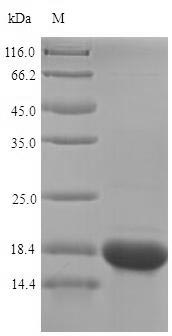 Greater than 90% as determined by SDS-PAGE.Recombinant Human Selenoprotein M (SELENOM) Protein (His)