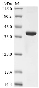 Greater than 90% as determined by SDS-PAGE.Recombinant Human A Disintegrin And Metalloproteinase With Thrombospondin Motifs 14 (ADAMTS14) Protein (His)