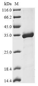 Greater than 90% as determined by SDS-PAGE.Recombinant Human Dna Repair Protein Rad50 (RAD50) Protein (His&Myc)