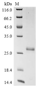Greater than 90% as determined by SDS-PAGE.Recombinant Human Potassium Voltage-Gated Channel Subfamily H Member 8 (KCNH8) Protein (His)