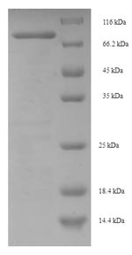 Greater than 90% as determined by SDS-PAGE.Recombinant Human Centrosomal Protein Of 63 Kda (CEP63) Protein (His-SUMO)