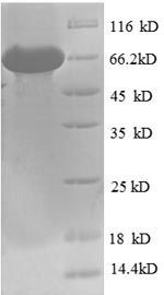 Greater than 90% as determined by SDS-PAGE.Recombinant Human Bile Acid Receptor (NR1H4) Protein (His-SUMO)