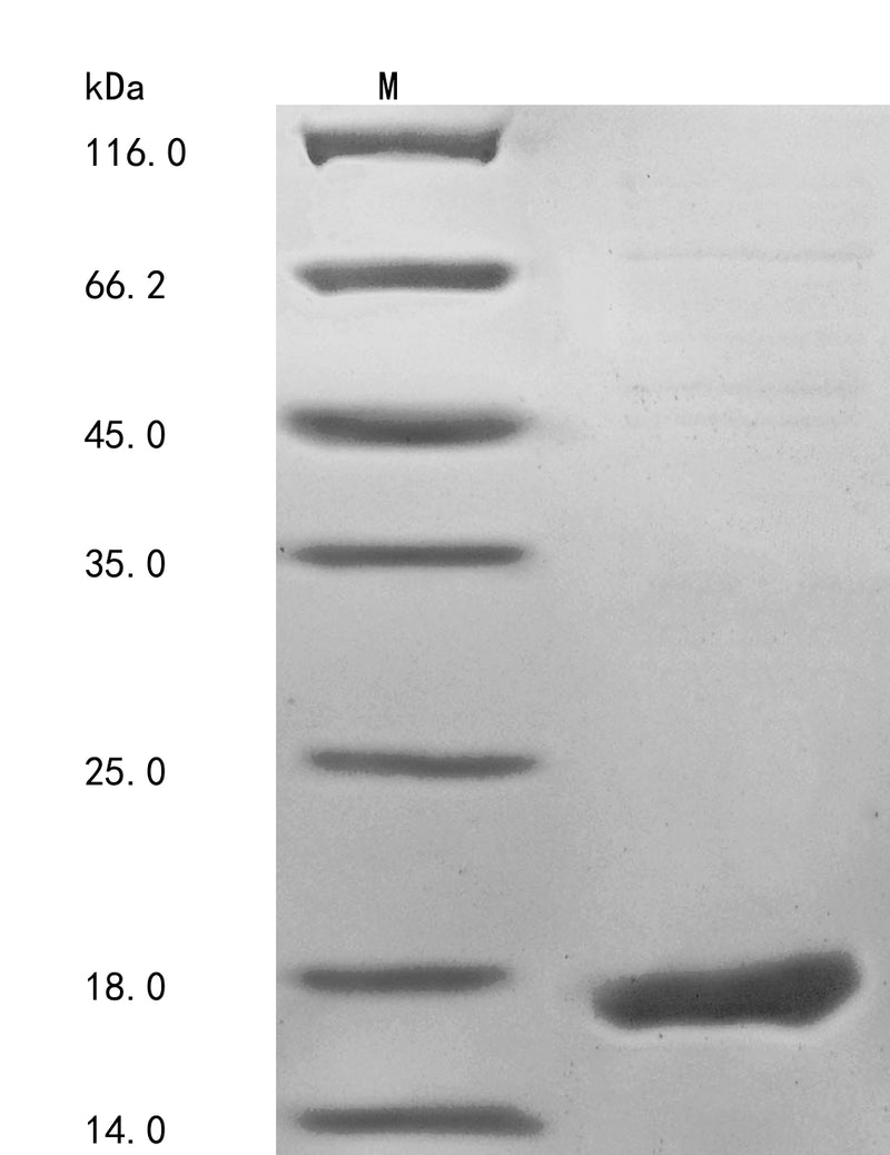 Greater than 85% as determined by SDS-PAGE.Recombinant Human Fragile X Mental Retardation 1 Neighbor Protein (FMR1NB) Protein (His&Myc)