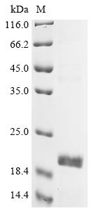 Greater than 90% as determined by SDS-PAGE.Recombinant Human Olfactory Receptor 7D4 (OR7D4) Protein (His-KSI)