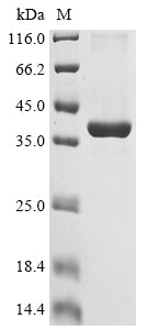 Greater than 90% as determined by SDS-PAGE.Recombinant Mouse Adipolin (C1QTNF12) Protein (His)