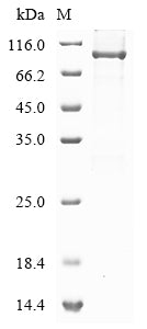 Greater than 85% as determined by SDS-PAGE.Recombinant Human Short Transient Receptor Potential Channel 4-Associated Protein (TRPC4AP) Protein (His)