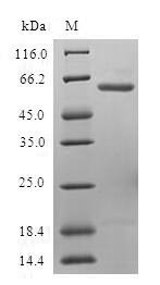 Greater than 90% as determined by SDS-PAGE.Recombinant Human Ubiquitin Fusion Degradation Protein 1 Homolog (UFD1) Protein (GST)