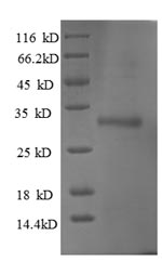 Greater than 90% as determined by SDS-PAGE.Recombinant Human Ubiquitin-Conjugating Enzyme E2 W (UBE2W) Protein (His-SUMO)