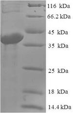 Greater than 90% as determined by SDS-PAGE.