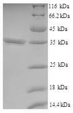 Greater than 90% as determined by SDS-PAGE.Recombinant Human V-Set And Transmembrane Domain-Containing Protein 2-Like Protein (VSTM2L) Protein (His-SUMO)