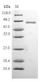 Greater than 90% as determined by SDS-PAGE.Recombinant Human Protein Quaking (QKI) Protein (GST)