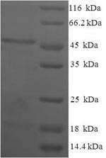 Greater than 90% as determined by SDS-PAGE.Recombinant Human Estradiol 17-Beta-Dehydrogenase 11 (HSD17B11) Protein (His-SUMO)