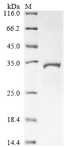 Greater than 85% as determined by SDS-PAGE.