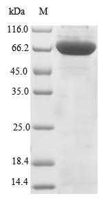 Greater than 85% as determined by SDS-PAGE.Recombinant Human Terminal Nucleotidyltransferase 4B (PAPD5) Protein (His-SUMO)