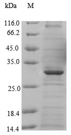 Greater than 90% as determined by SDS-PAGE.Recombinant Human Major Facilitator Superfamily Domain-Containing Protein 8 (MFSD8) Protein (His-GST)