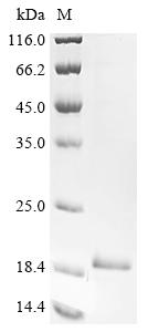 Greater than 90% as determined by SDS-PAGE.Recombinant Mouse Angiopoietin-Like Protein 8 (ANGPTL8) Protein (His)