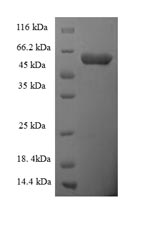 Greater than 90% as determined by SDS-PAGE.Recombinant Human Scavenger Receptor Class B Member 1 (SCARB1) Protein (His-SUMO)