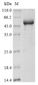 Greater than 85% as determined by SDS-PAGE.Recombinant Human Dna Damage-Binding Protein 2 (DDB2) Protein (His)