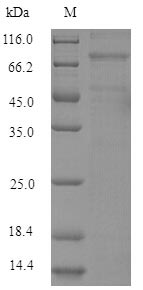 Greater than 90% as determined by SDS-PAGE.Recombinant Mouse Lysyl Oxidase Homolog 4 (LOXL4) Protein (His)