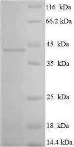 Greater than 90% as determined by SDS-PAGE.