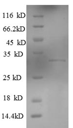 Greater than 90% as determined by SDS-PAGE.Recombinant Human Killer Cell Lectin-Like Receptor Subfamily G Member 1 (KLRG1) Protein (His-SUMO)