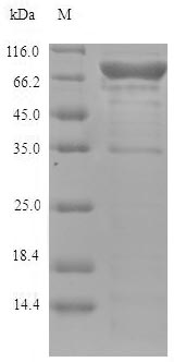 Greater than 90% as determined by SDS-PAGE.Recombinant Human Lysyl Oxidase Homolog 4 (LOXL4) Protein (His)