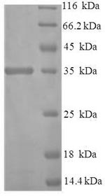 Greater than 90% as determined by SDS-PAGE.