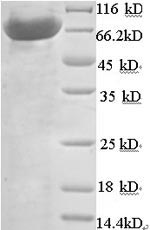 Greater than 90% as determined by SDS-PAGE.Recombinant Human N-Acetylmuramoyl-L-Alanine Amidase (PGLYRP2) Protein (His-SUMO)