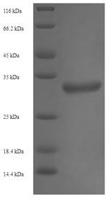 Greater than 90% as determined by SDS-PAGE.Recombinant Human Trimethylguanosine Synthase (TGS1) Protein (His-SUMO)