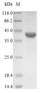 Greater than 85% as determined by SDS-PAGE.Recombinant Human Thioredoxin Domain-Containing Protein 5 (TXNDC5)