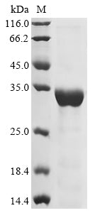 Greater than 85% as determined by SDS-PAGE.Recombinant Mouse Nad-Dependent Protein Deacetylase Sirtuin-3 (SIRT3) Protein (His&Myc)