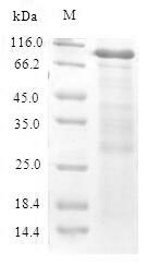 Greater than 90% as determined by SDS-PAGE.Recombinant Mouse Cystathionine Beta-Synthase (CBS) Protein (His-SUMO)