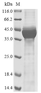 Greater than 85% as determined by SDS-PAGE.Recombinant Human Hamartin (TSC1) Protein (His)