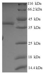 Greater than 90% as determined by SDS-PAGE.