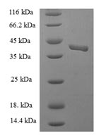 Greater than 90% as determined by SDS-PAGE.Recombinant Human Endothelial Cell-Selective Adhesion Molecule (ESAM) Protein (His-SUMO)