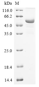 Greater than 85% as determined by SDS-PAGE.Recombinant Mouse Sodium/Potassium-Transporting Atpase Subunit Alpha-1 (ATP1A1) Protein (His)