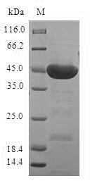 Greater than 90% as determined by SDS-PAGE.Recombinant Human Serine/Threonine-Protein Kinase 32A (STK32A) Protein (GST)