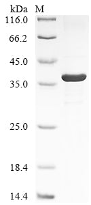 Greater than 85% as determined by SDS-PAGE.Recombinant Human Intelectin-1 (ITLN1) Protein (His&Myc)
