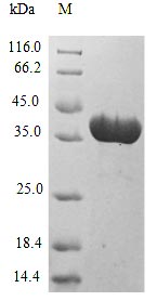 Greater than 85% as determined by SDS-PAGE.Recombinant Neosartorya Fumigata Superoxide Dismutase [Mn], Mitochondrial (SODB) Protein (His-SUMO)