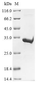 Greater than 90% as determined by SDS-PAGE.Recombinant Human Piezo-Type Mechanosensitive Ion Channel Component 1 (PIEZO1) Protein (His&Myc)