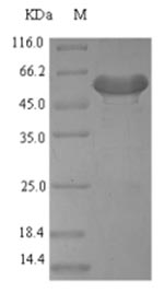 Greater than 90% as determined by SDS-PAGE.Recombinant Mouse Platelet-Derived Growth Factor D (PDGFD) Protein (His-SUMO)