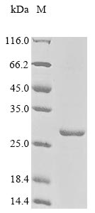 Greater than 85% as determined by SDS-PAGE.Recombinant Human Myocardin-Related Transcription Factor A (MKL1) Protein (His-KSI)