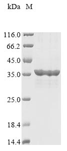 Greater than 85% as determined by SDS-PAGE.Recombinant Human Spry Domain-Containing Socs Box Protein 1 (SPSB1) Protein (His&Myc)